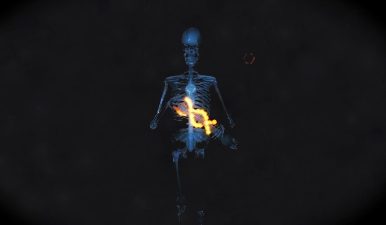 Bones